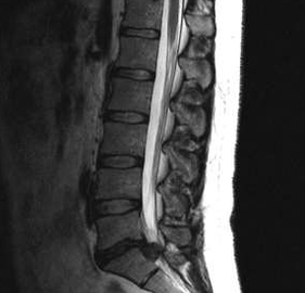 Nimme osteokondroosi diagnostilised võimalused