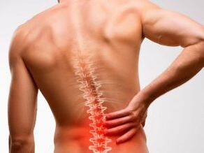 osteokondroosist tingitud alaseljavalu